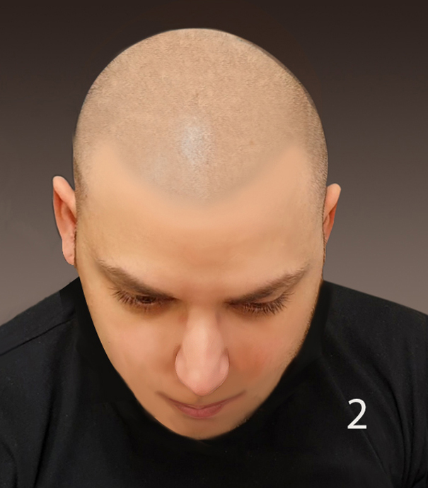 Model 2